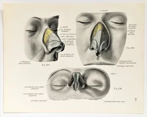 Anatomisk tegning av nesen, cirka 1900